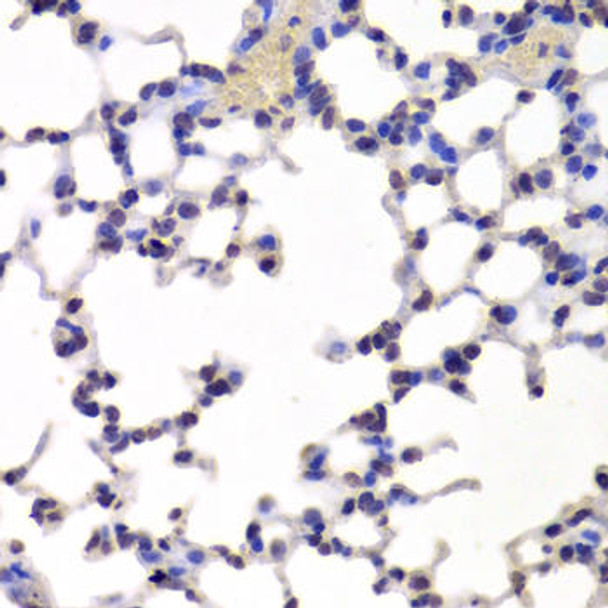 Cell Biology Antibodies 10 Anti-INTS6 Antibody CAB6634