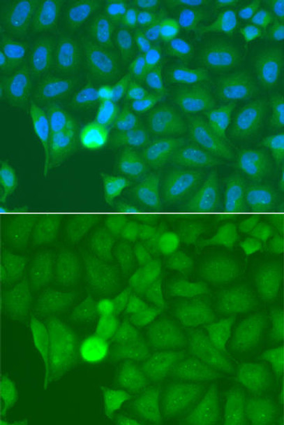 Cell Biology Antibodies 10 Anti-IRAK2 Antibody CAB6635