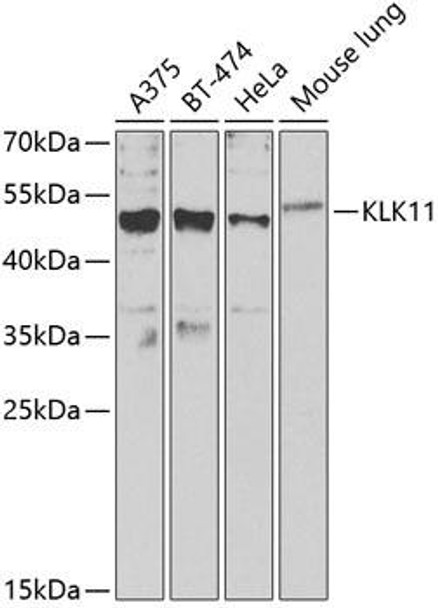 Cell Biology Antibodies 10 Anti-KLK11 Antibody CAB6641