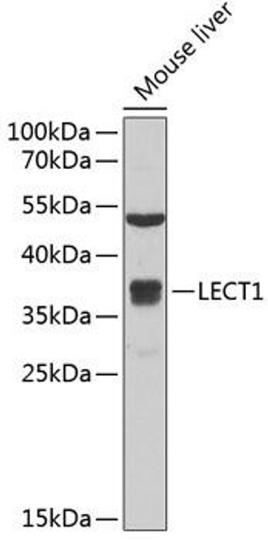 Cell Biology Antibodies 10 Anti-LECT1 Antibody CAB6644