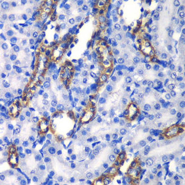 Cell Biology Antibodies 10 Anti-MATK Antibody CAB6651