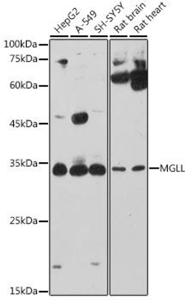 Metabolism Antibodies 2 Anti-MGLL Antibody CAB6654
