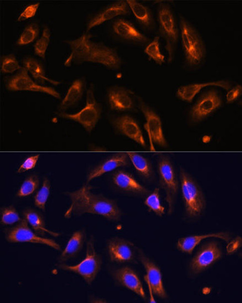 Cell Biology Antibodies 10 Anti-MLPH Antibody CAB6656