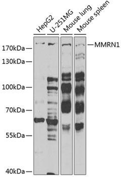 Cell Biology Antibodies 10 Anti-MMRN1 Antibody CAB6658