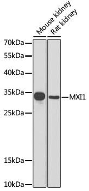 Epigenetics and Nuclear Signaling Antibodies 4 Anti-MXI1 Antibody CAB6661