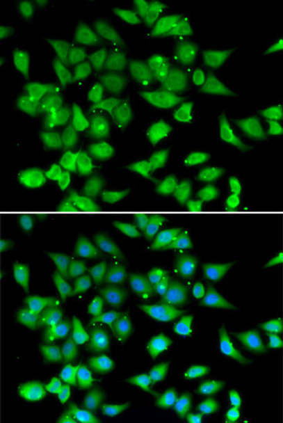 Epigenetics and Nuclear Signaling Antibodies 4 Anti-NFATC3 Antibody CAB6666