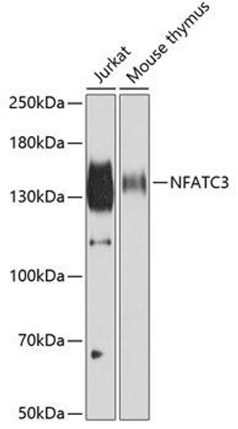 Epigenetics and Nuclear Signaling Antibodies 4 Anti-NFATC3 Antibody CAB6666