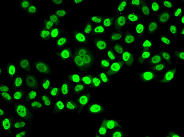 Cell Cycle Antibodies 1 Anti-NUDC Antibody CAB6678