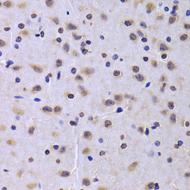 Cell Cycle Antibodies 1 Anti-NUDC Antibody CAB6678