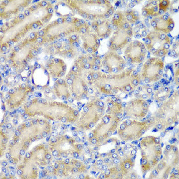 Cardiovascular Antibodies Anti-PDCD6 Antibody CAB6685