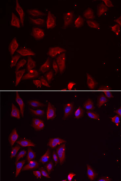 Cell Biology Antibodies 10 Anti-PDXK Antibody CAB6687