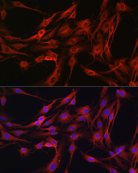 Cardiovascular Antibodies Anti-PIK3CG Antibody CAB6688