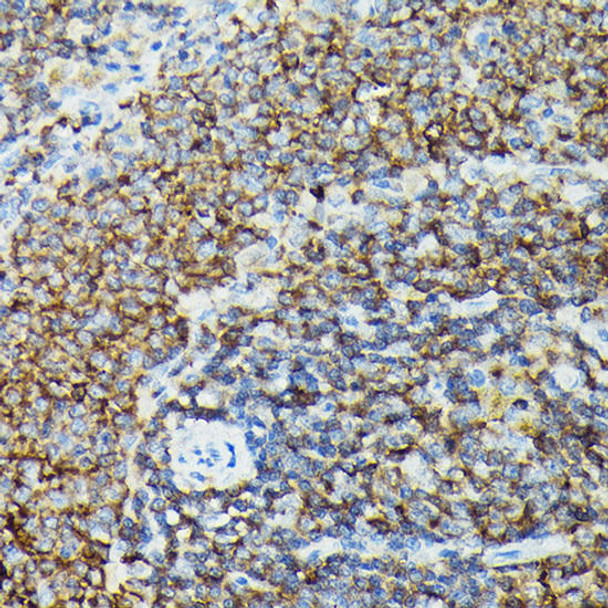 Cardiovascular Antibodies Anti-PIK3CG Antibody CAB6688