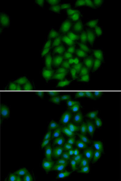 Immunology Antibodies 2 Anti-PLSCR1 Antibody CAB6691