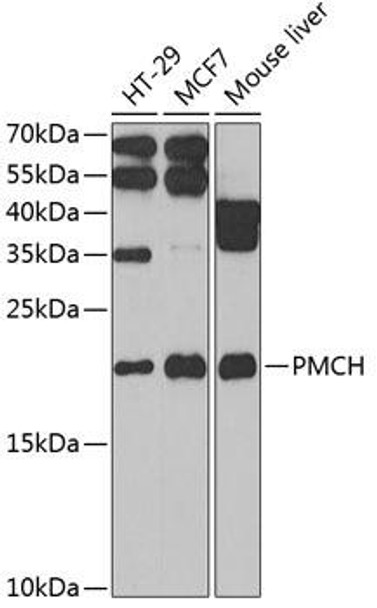 Developmental Biology Anti-PMCH Antibody CAB6692