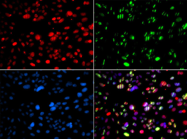 Epigenetics and Nuclear Signaling Antibodies 4 Anti-PNKP Antibody CAB6693