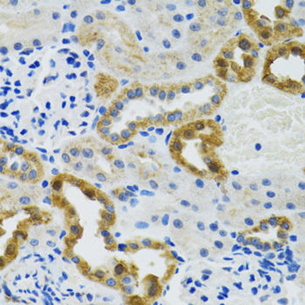 Epigenetics and Nuclear Signaling Antibodies 4 Anti-POLG2 Antibody CAB6695