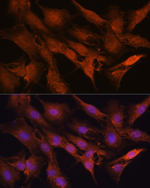 Cell Biology Antibodies 10 Anti-PPM1A Antibody CAB6699