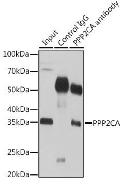 Cell Biology Antibodies 10 Anti-PPP2CA Antibody CAB6702