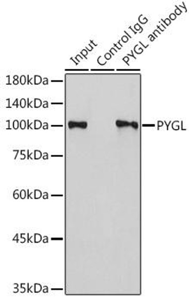 Metabolism Antibodies 2 Anti-PYGL Antibody CAB6710