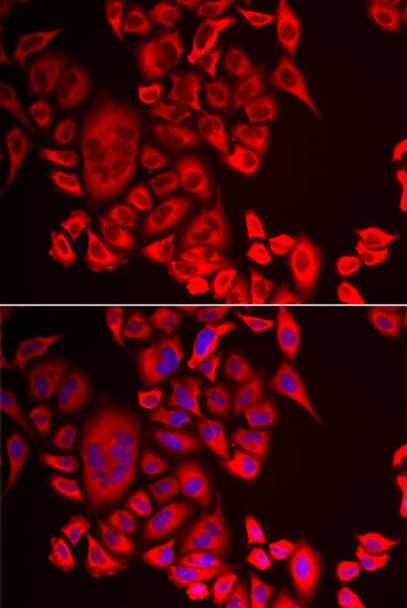 Cell Biology Antibodies 10 Anti-QPCT Antibody CAB6711