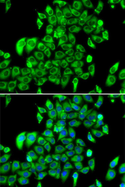 Cell Biology Antibodies 10 Anti-RPL13 Antibody CAB6723