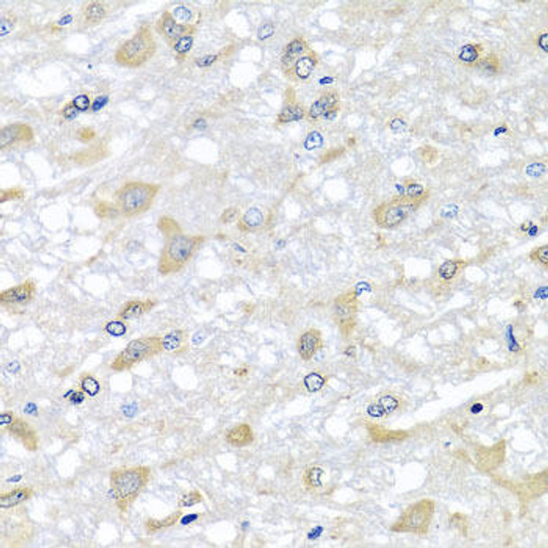 Cell Biology Antibodies 10 Anti-RPLP1 Antibody CAB6725