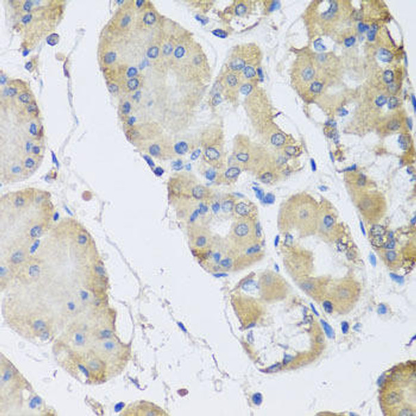 Cell Biology Antibodies 10 Anti-RPLP1 Antibody CAB6725