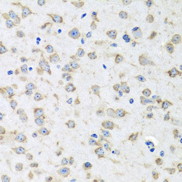 Cell Biology Antibodies 10 Anti-RPLP1 Antibody CAB6725