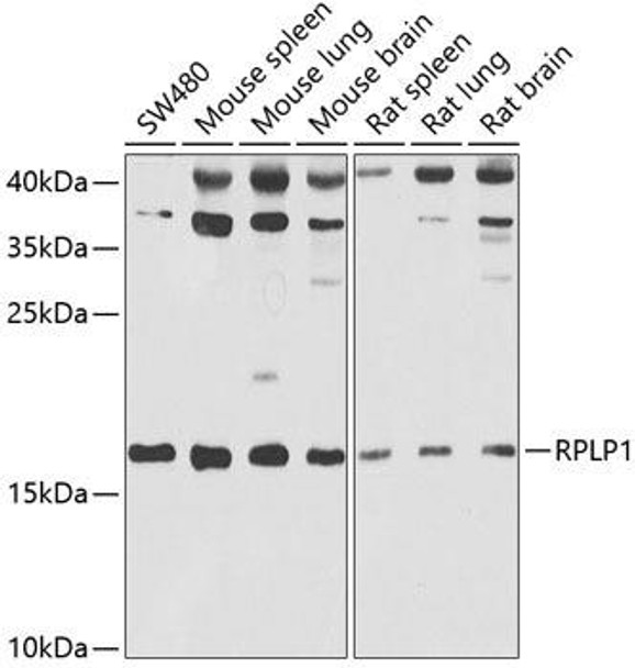 Cell Biology Antibodies 10 Anti-RPLP1 Antibody CAB6725