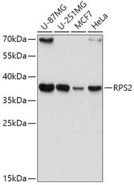 Cell Biology Antibodies 10 Anti-RPS2 Antibody CAB6728