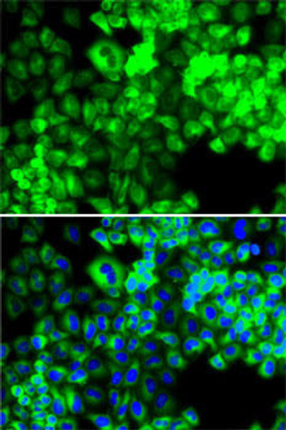 Metabolism Antibodies 2 Anti-SARS Antibody CAB6733