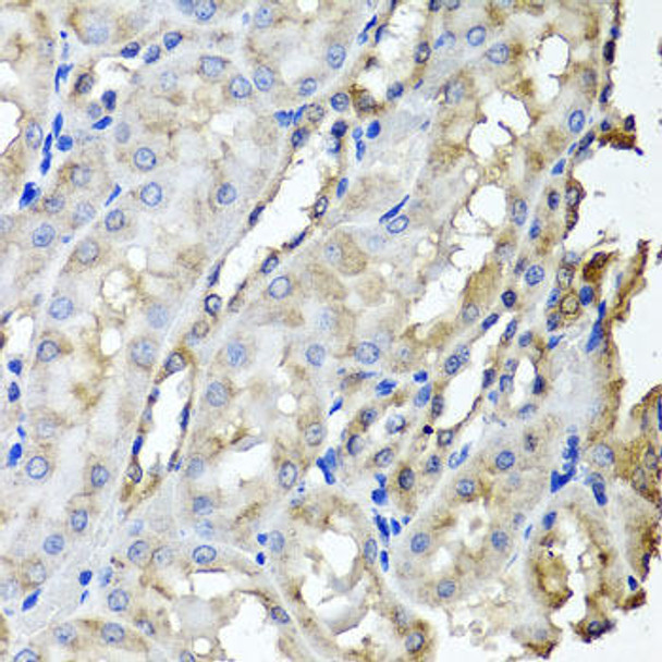 Cell Biology Antibodies 10 Anti-SCYL1 Antibody CAB6735