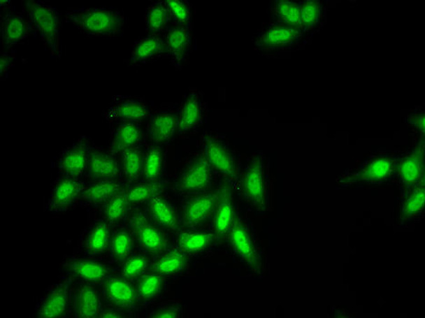 Epigenetics and Nuclear Signaling Antibodies 4 Anti-SETMAR Antibody CAB6738