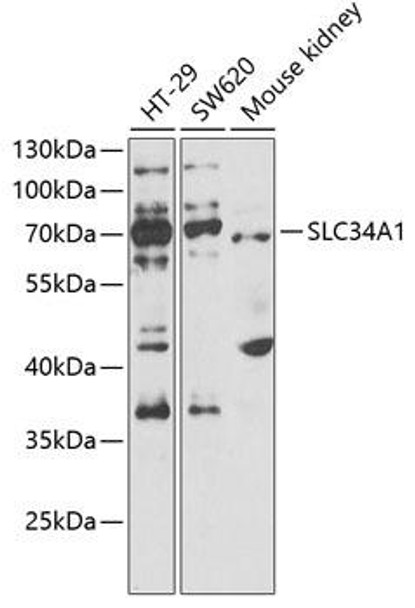 Signal Transduction Antibodies 3 Anti-SLC34A1 Antibody CAB6742