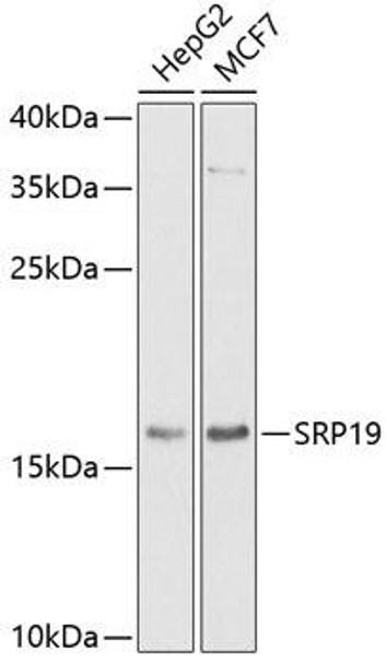 Cell Biology Antibodies 10 Anti-SRP19 Antibody CAB6752