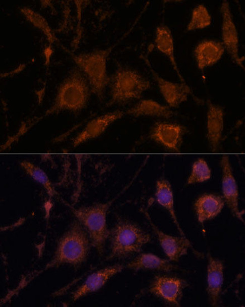 Cell Biology Antibodies 10 Anti-STC1 Antibody CAB6755