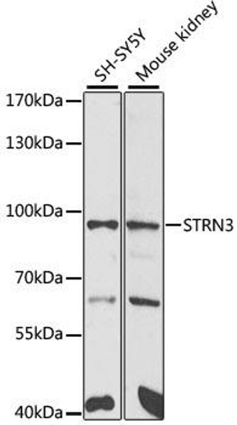 Cell Biology Antibodies 10 Anti-STRN3 Antibody CAB6756
