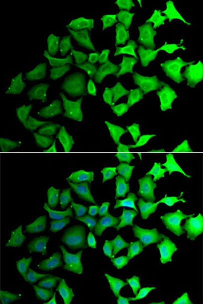 Metabolism Antibodies 2 Anti-TALDO1 Antibody CAB6762