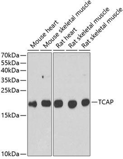 Cell Biology Antibodies 10 Anti-TCAP Antibody CAB6765