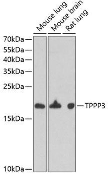 Cell Biology Antibodies 10 Anti-TPPP3 Antibody CAB6775