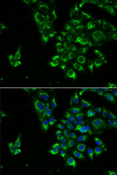 Cell Biology Antibodies 10 Anti-TSHB Antibody CAB6780