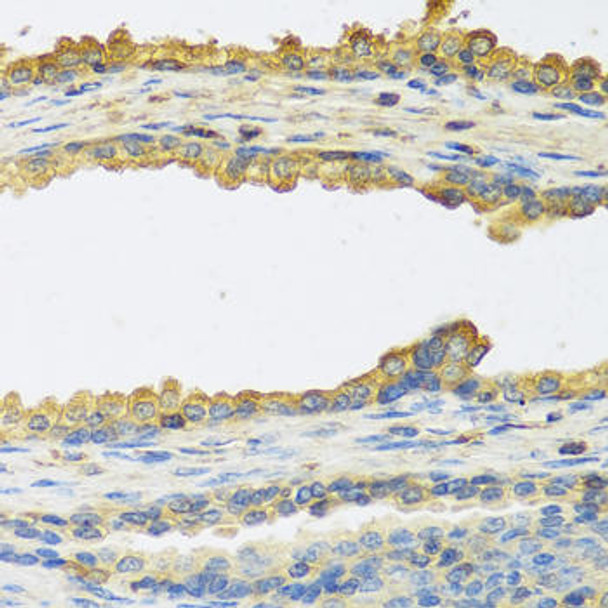 Cell Biology Antibodies 10 Anti-TSHB Antibody CAB6780