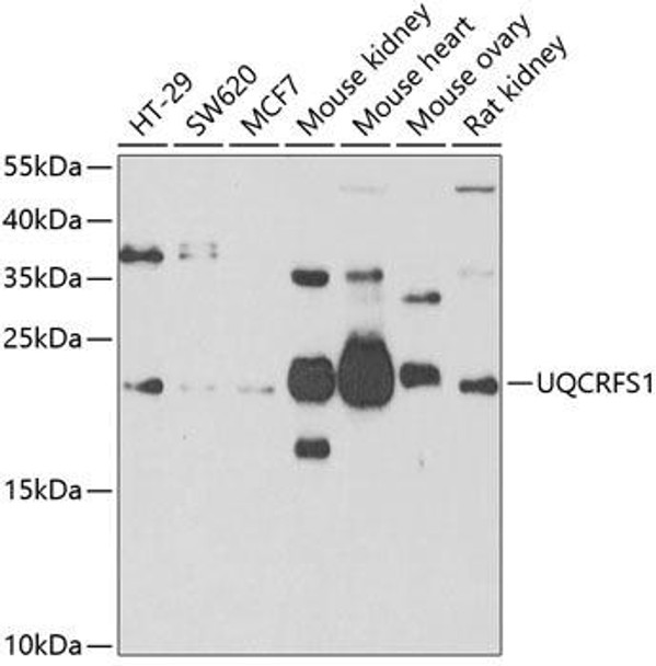 Cell Biology Antibodies 10 Anti-UQCRFS1 Antibody CAB6784