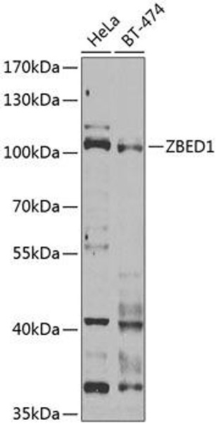 Cell Biology Antibodies 10 Anti-ZBED1 Antibody CAB6792