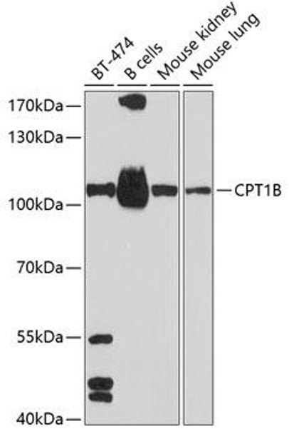 Metabolism Antibodies 2 Anti-CPT1B Antibody CAB6796