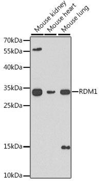 Cell Biology Antibodies 10 Anti-RDM1 Antibody CAB6845