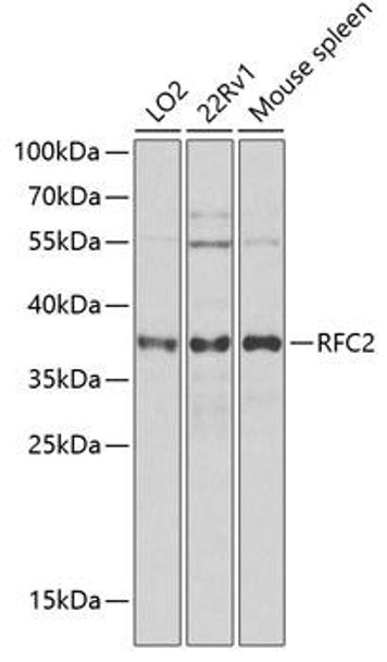 Epigenetics and Nuclear Signaling Antibodies 4 Anti-RFC2 Antibody CAB6847