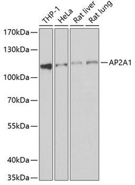 Cell Biology Antibodies 10 Anti-AP2A1 Antibody CAB6863