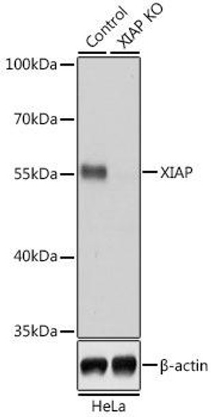 KO Validated Antibodies 1 Anti-XIAP Antibody CAB6869KO Validated